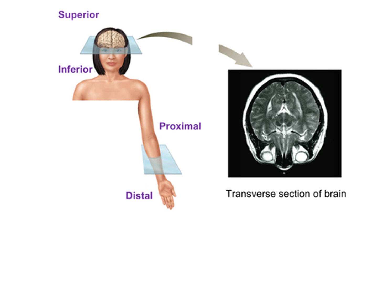 <p>The ______________________ plane (also called the horizontal plane)</p><p>i. Divides the axial region into superior and inferior sections</p><p>ii. Divides the appendicular region into proximal and distal sections</p><p>A) Sagittal plane</p><p>B) Frontal plane</p><p>C) Transverse plane</p><p>D) Parasagittal plane</p>