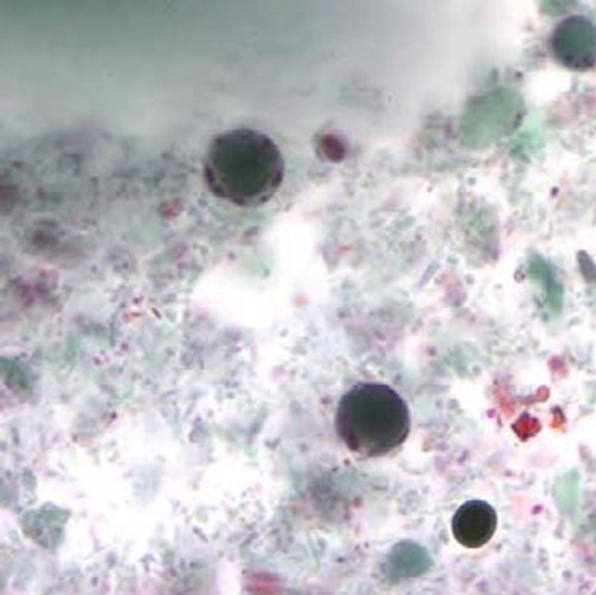 <p>a. Blastocystis hominis</p>