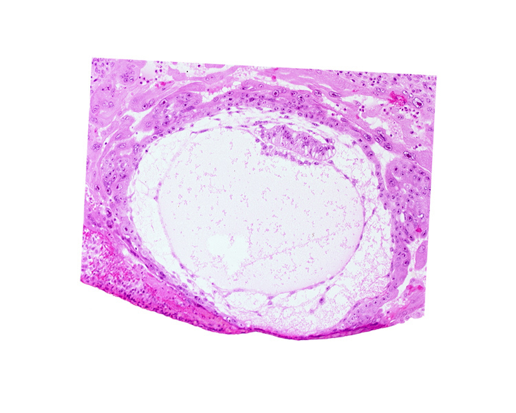 <p>Label the following:</p><ul><li><p>amniotic cavity</p></li><li><p>amnion</p></li><li><p>lacunar vascular circle</p></li><li><p>Heuser’s membrane</p></li><li><p>chorionic cavity</p></li><li><p>hypoblast</p></li><li><p>cytotrophoblast</p></li></ul><p></p>