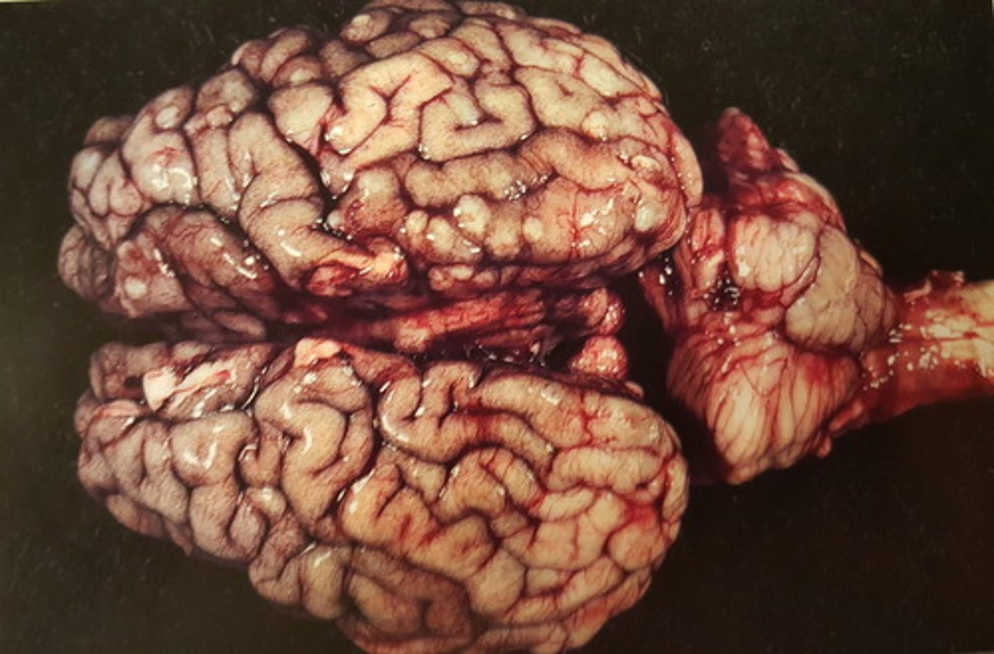 <p>Hjerne fra okse. Patoanatomisk diagnose? Hvordan kan det opstå?</p>