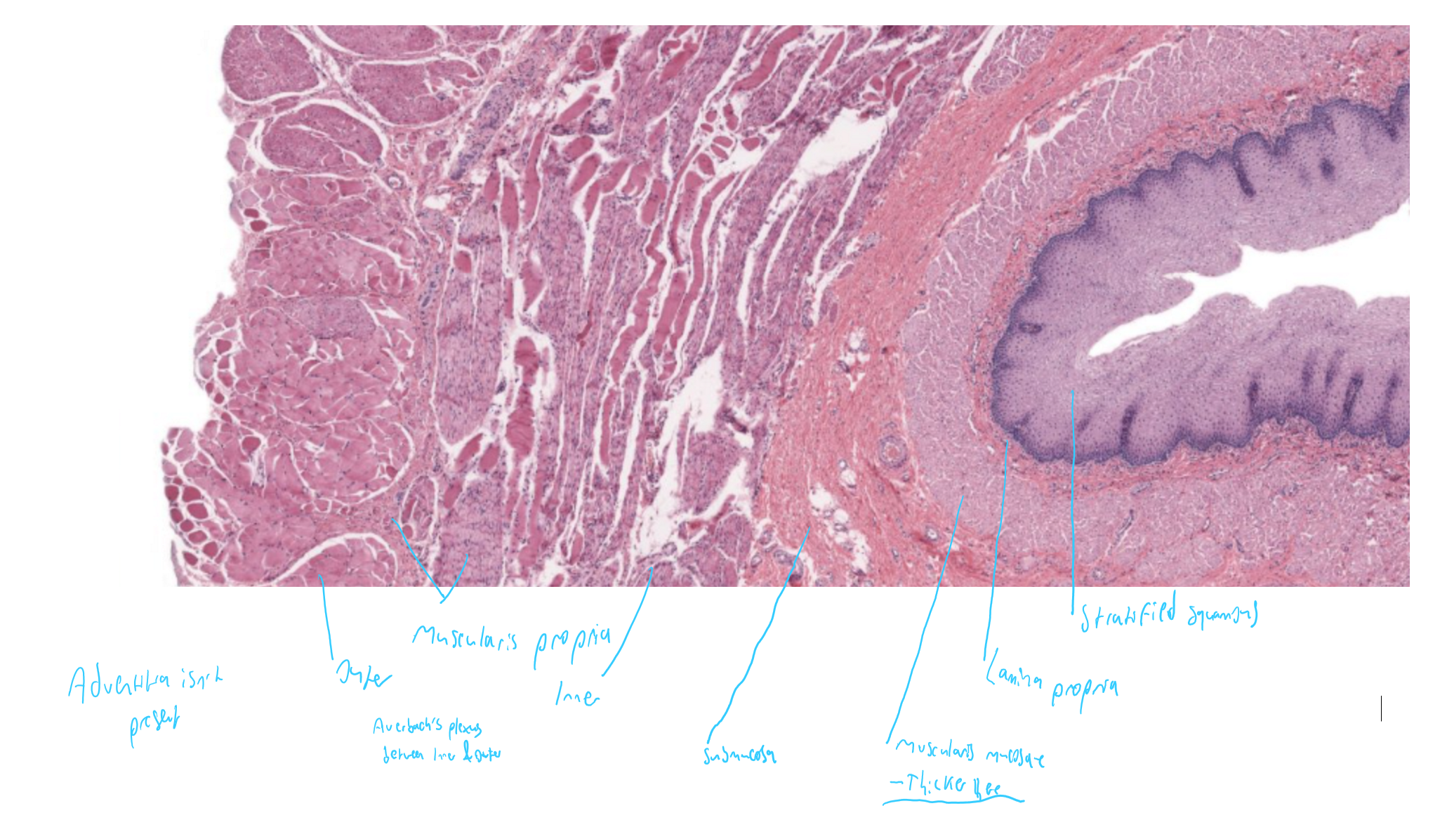 <p>oesophagus, stratified squamous epithelium</p>
