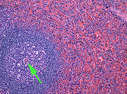 <p>The artery at the end of the green arrow is the <strong> </strong><span><strong>central </strong></span>artery of the spleen.</p>