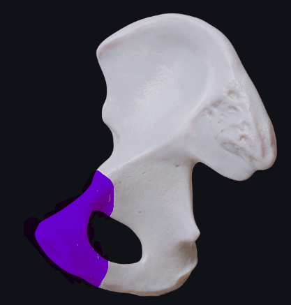 <p>What bone is this?</p>