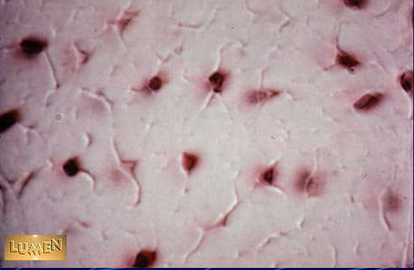 <p>this figure describes what?</p>