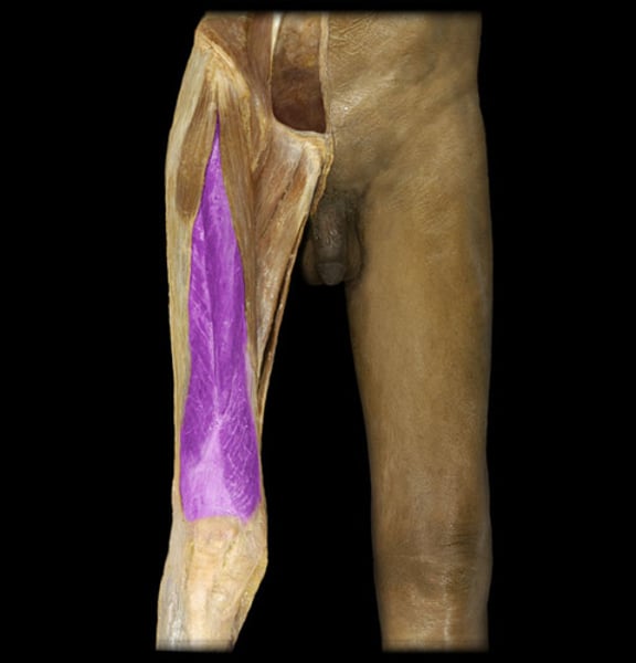 <p>IDENTIFY THIS MUSCLE</p>