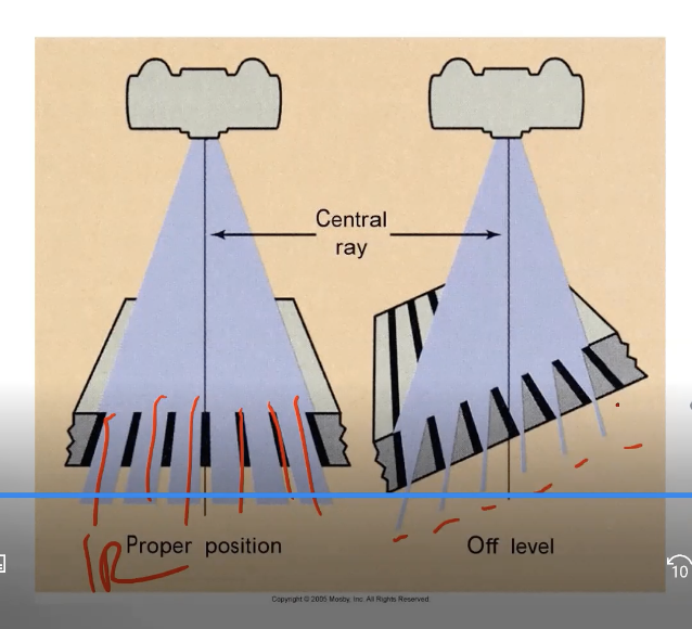 <p><strong>Why does a Crosshatch Grid provide Excellent Efficiency? </strong>(Look at the image between the parallel aligned and non parallel x rays)</p>