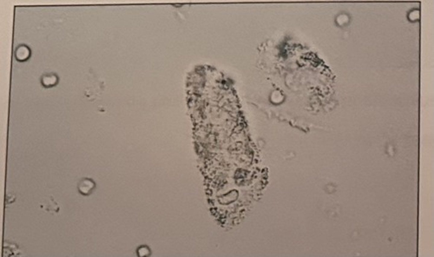 <p>Identify the types of cast seen photomicrograph:</p><p>a. broad</p><p>b. hyaline</p><p>c. cellular</p><p>d. granular</p>
