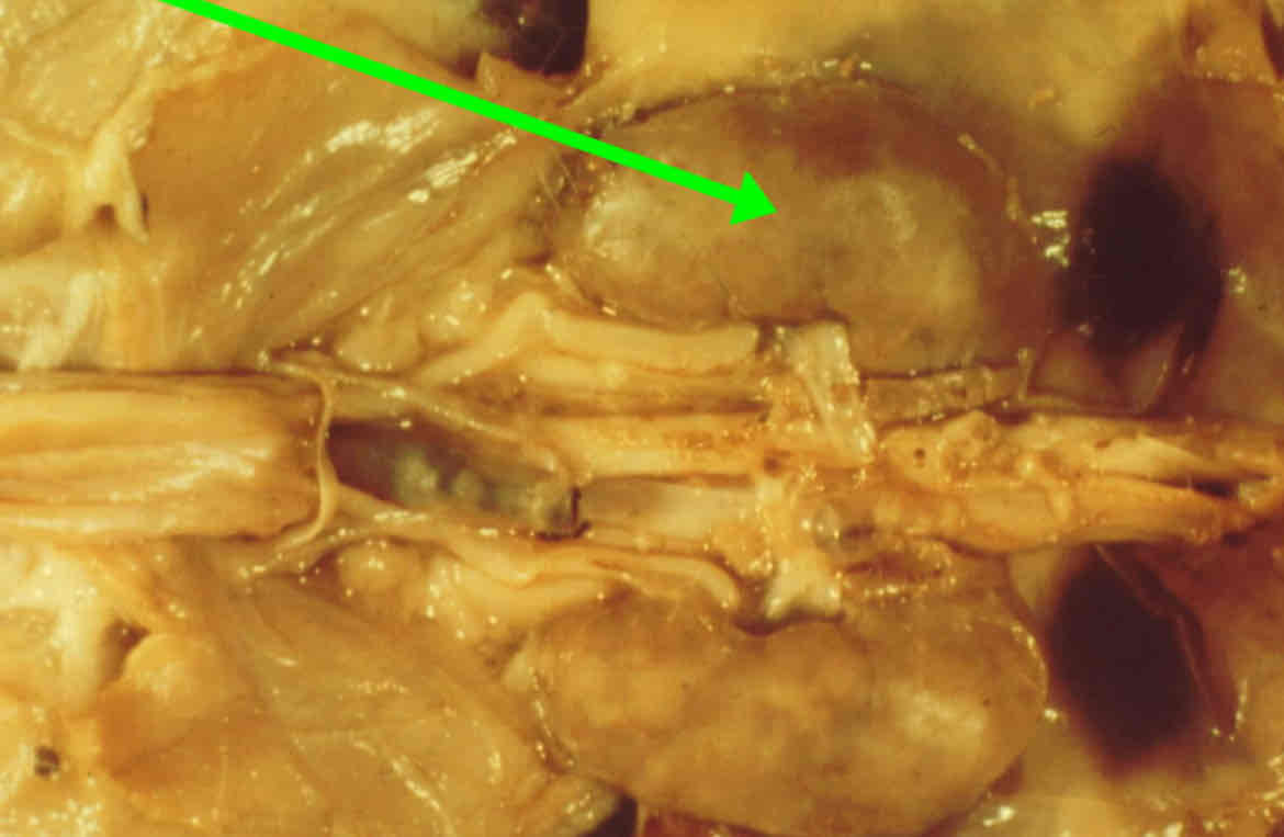 <p>Identify this structure</p>