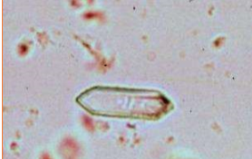 <p>Name the crystal</p>