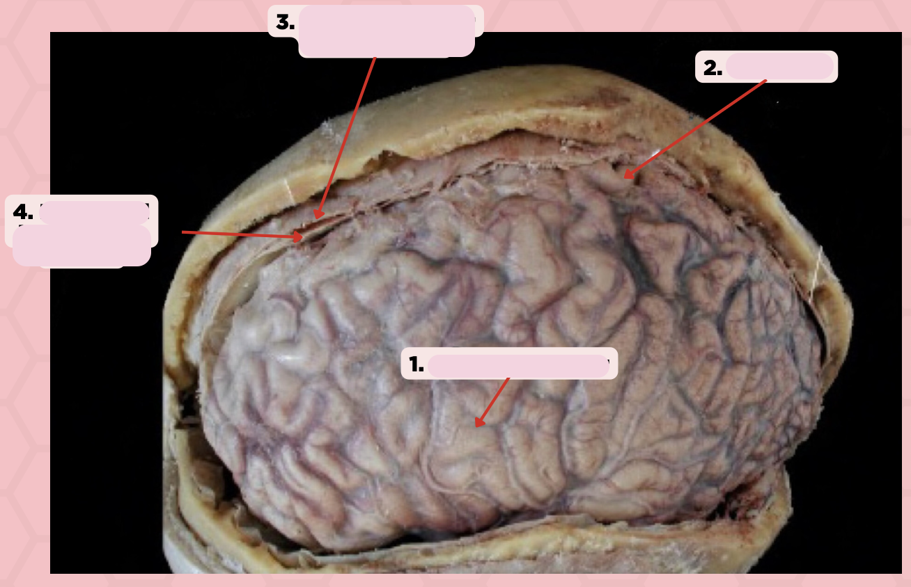 <p>Identify the structure labeled as 4.</p>