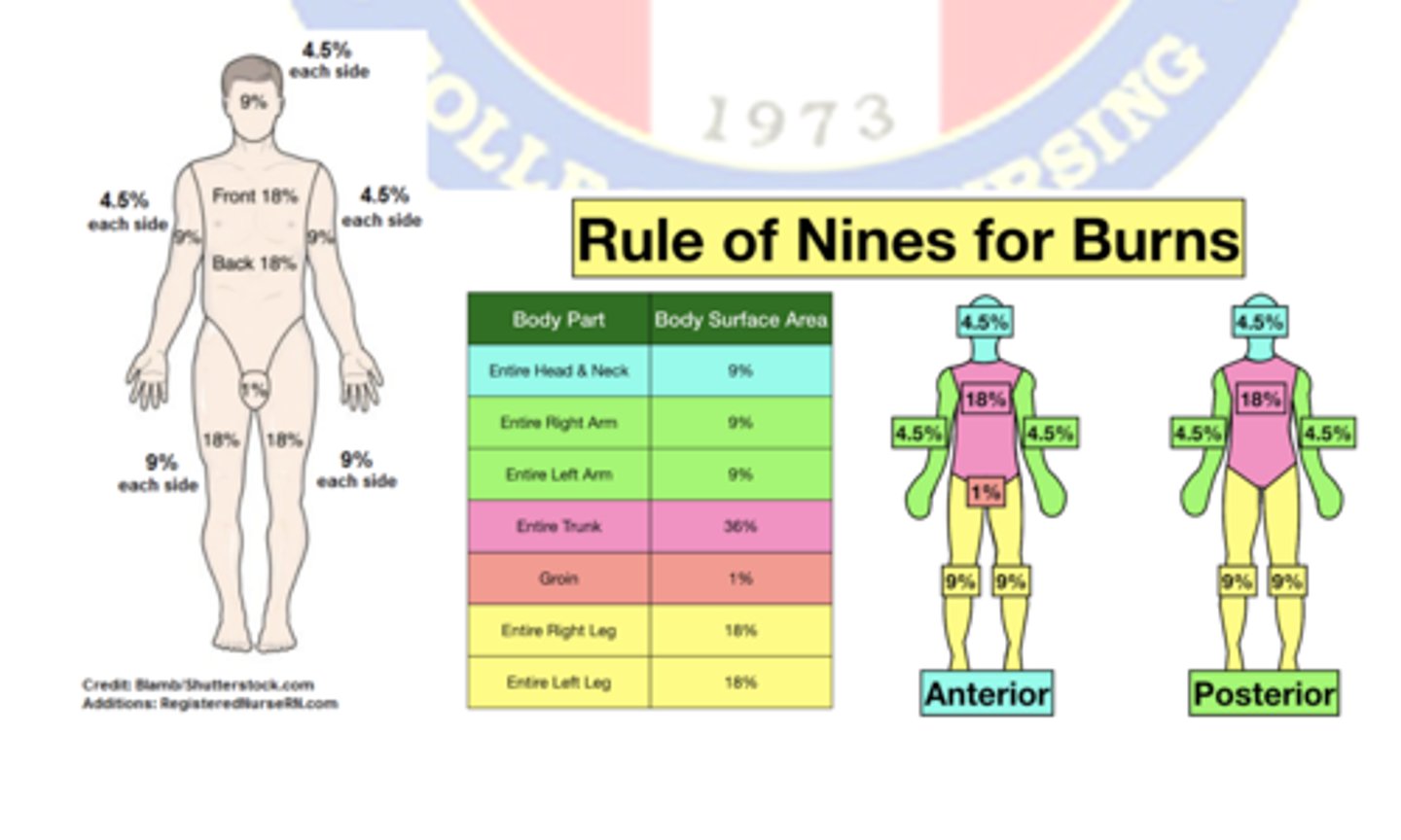 <p>Rules of nine</p>