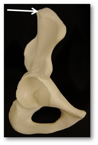 Name this specific part of the ilium.