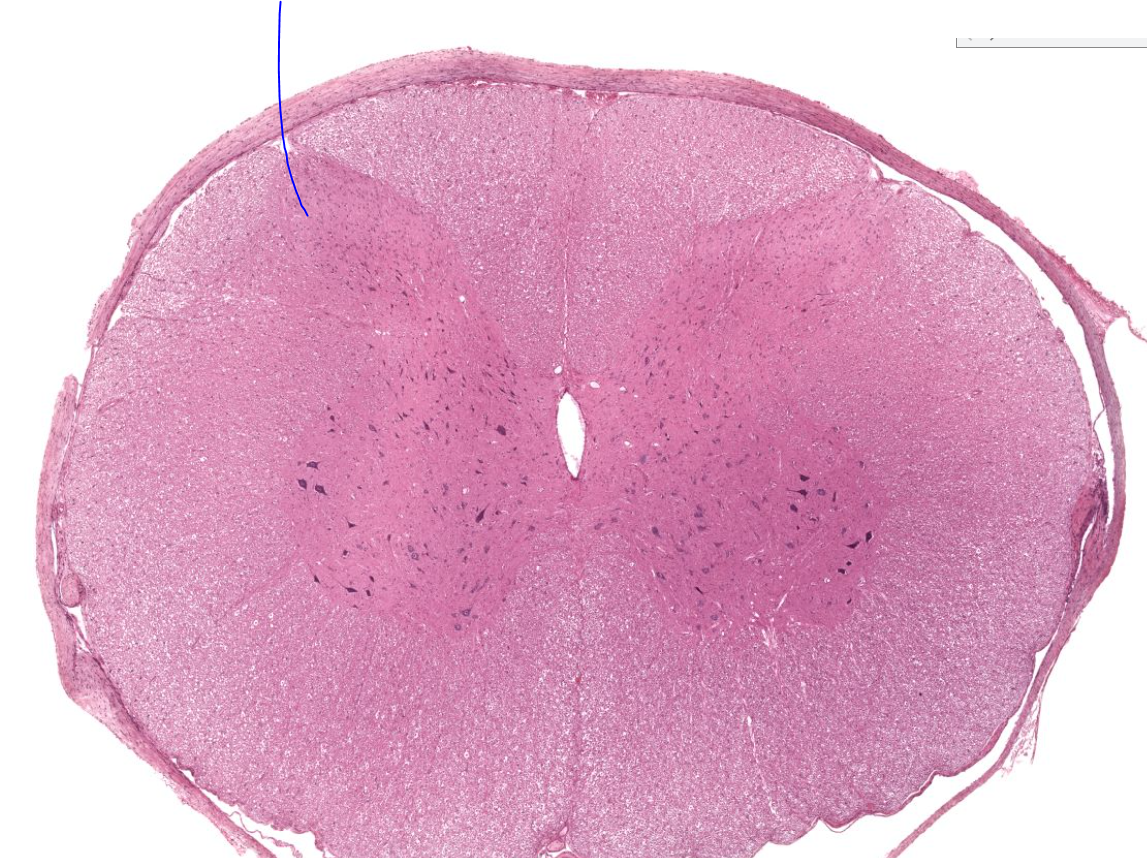 <p>upper wings of gray matter that receive sensory input from peripheral nerves. </p>