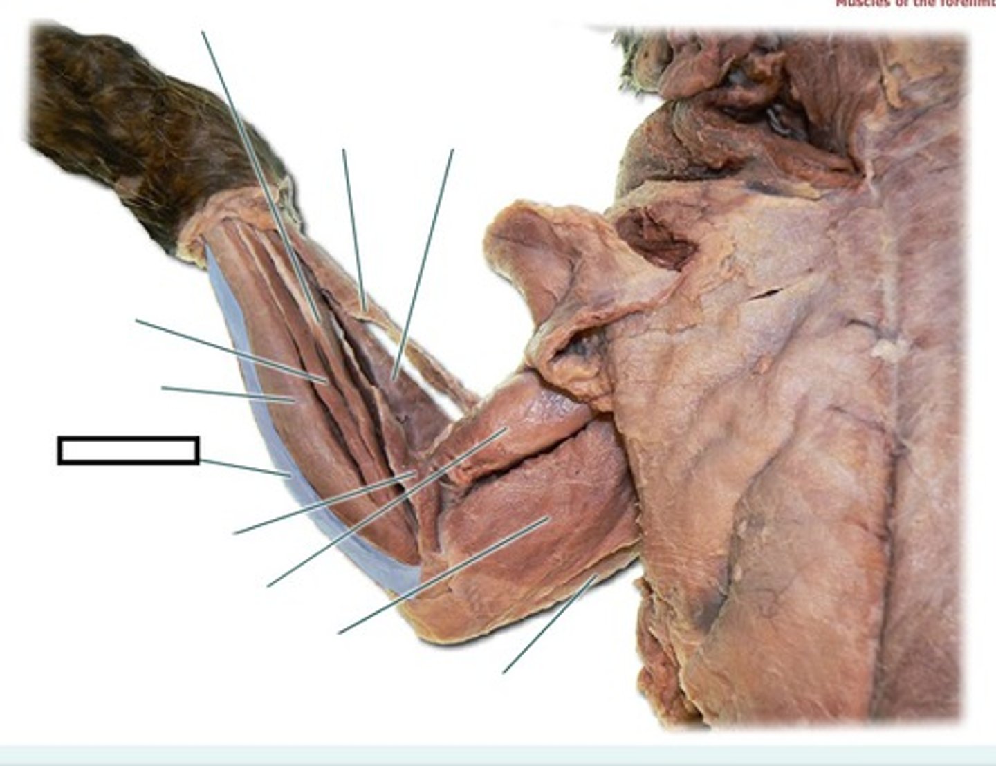 <p>What muscle is this?</p><p>Origin?</p><p>Insertion?</p><p>Action?</p><p>Nerve?</p>