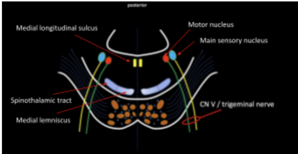 <p>Medial Longitudinal Fasciculus</p>