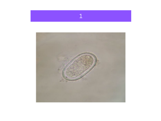 <p>what is&nbsp;1</p>