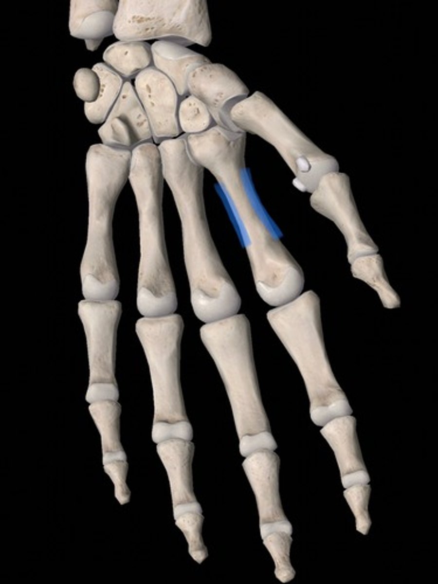 <p>bone</p>