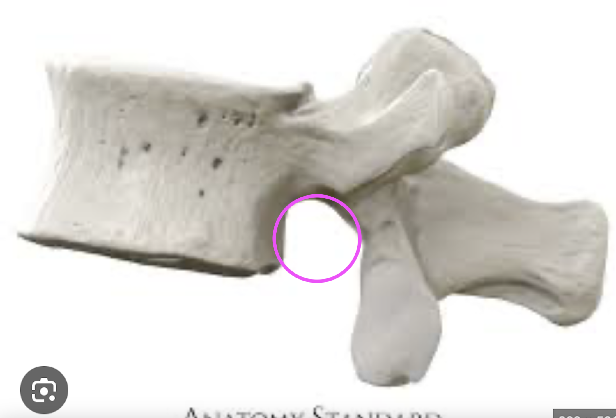 <p>What part of the vertebrae is this?</p>
