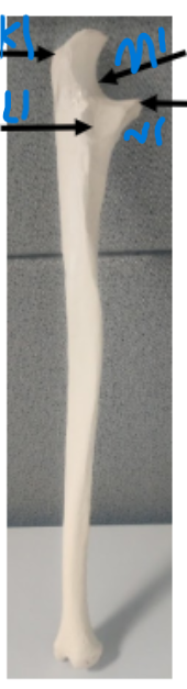 <p>What is L1? on the ulna</p>