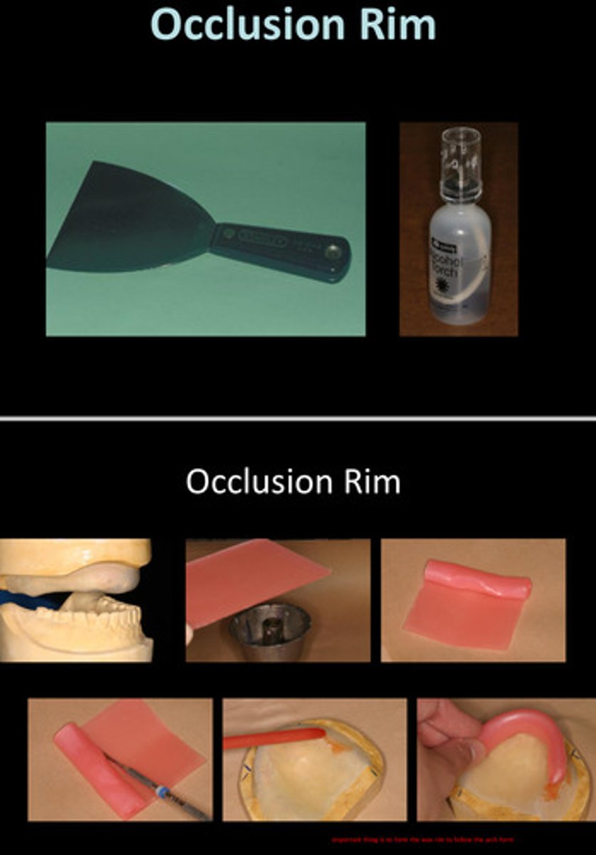 <p>we want the wax rim to conform to the contour of the ridge —> contour of wax rim should approximate shape and B-L position of final denture teeth</p>