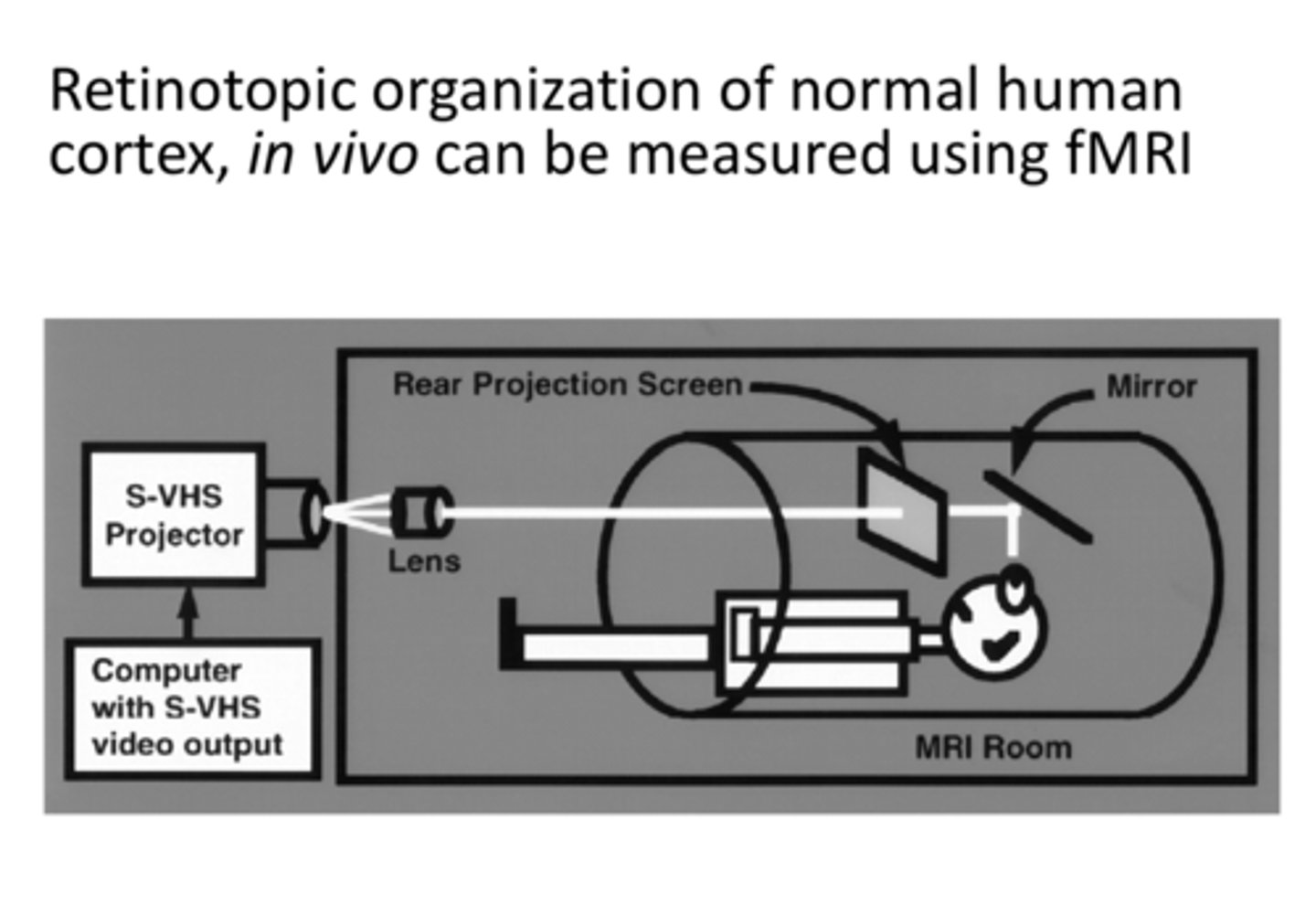<p>Retinotopic organization of normal human cortex, in vivo, can be measured using _____</p>