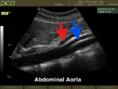 <ol><li><p>What structure is seen at the red arrow?</p></li><li><p>What structure is seen at the blue arrow?</p></li></ol><p></p>