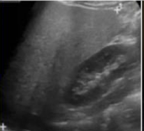 <p>What is this and what type of scan </p>