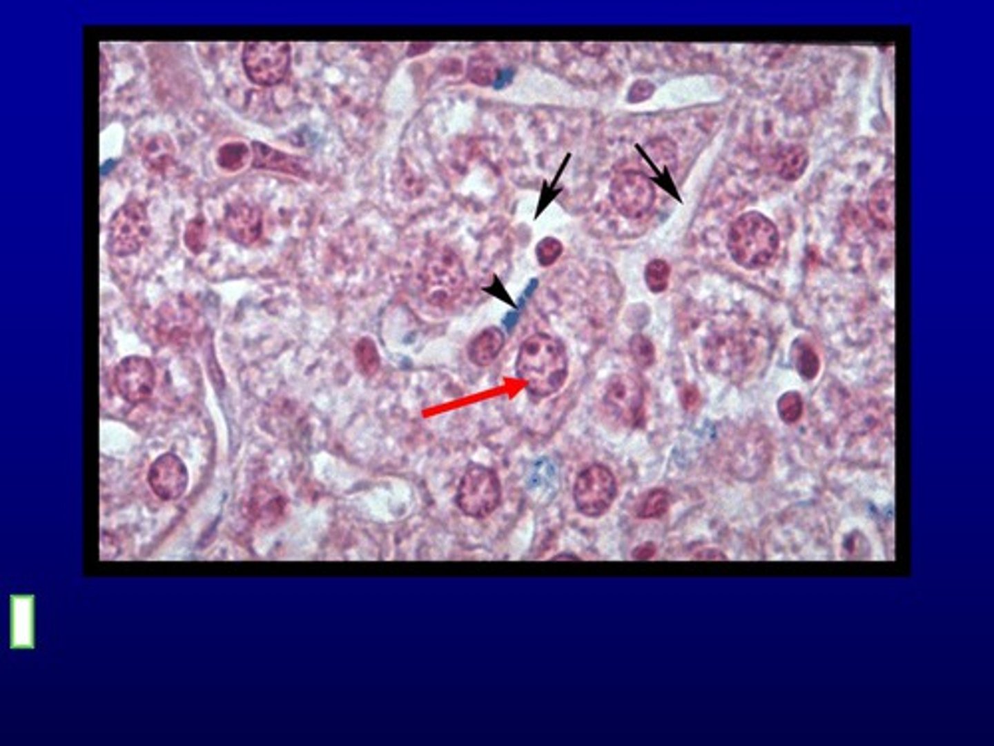<p>After a phagocytic cell has digested an antigen, it displays antigen fragments on its cell surface and is now referred to as... (This reports to other cells about the pathogen it is processing)</p>