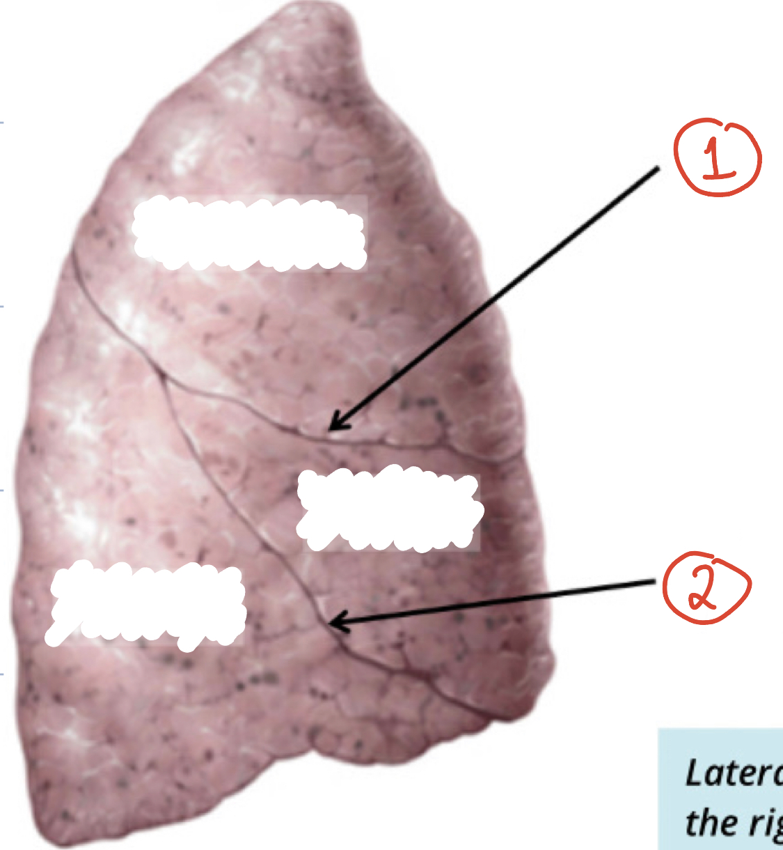 fissures of right lung (2)