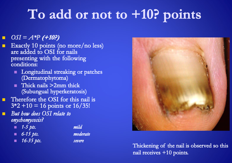 <p>OSI related to onychomycosis</p><ul><li><p>Mild: <span><strong>[...]</strong></span> to <span><strong>[...]</strong></span> points</p></li><li><p>Moderate: <span><strong>[...]</strong></span> to <span><strong>[...]</strong></span> points</p></li><li><p>Severe: <span><strong>[...]</strong></span> to <span><strong>[...]</strong></span> points&nbsp;</p></li></ul><p></p>