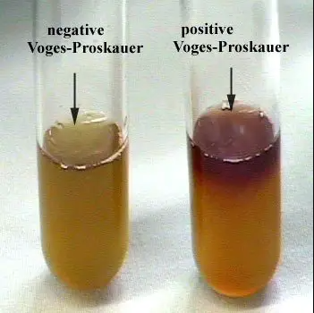 <ul><li><p><strong>Purpose</strong>: to detect the production of acetoin or butanediol from the fermentation of glucose in the broth</p><ul><li><p>Part of the IMViC tests.</p></li></ul></li><li><p><strong>Medium</strong>: MRVP broth-- buffered glucose peptone broth</p></li><li><p><strong>Type of Medium</strong>: differential</p></li><li><p><strong>+ results</strong> = red layer at the top in 10 minutes (earliest detection), progressing downward</p></li><li><p><strong>- results</strong> = no red color, disregard any copper or brownish-purple color</p></li><li><p><strong>significant specific ingredients:</strong></p></li><li><p><strong>reagents/indicators:</strong> Barritt’s reagents A and B added AFTER incubation</p></li><li><p><strong>specific directions</strong> (if any): inoculate broth and incubate. After incubation add 20 drops of Barritt’s Reagent A and 20 drops of Barritt’s Reagent B. Vortex at frequent intervals and allow the reaction to develop for up to 1 – 2 hours.</p></li><li><p><strong>significant results:</strong></p></li></ul>