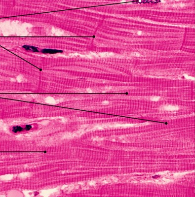 <p>Which type of muscle is:</p><ul><li><p>Are striated, involuntary, heart muscle</p></li><li><p>Form branching networks - bifurcated</p></li><li><p>Connected at intercalated disks</p></li><li><p>Have large round nuclei</p></li></ul><p></p>