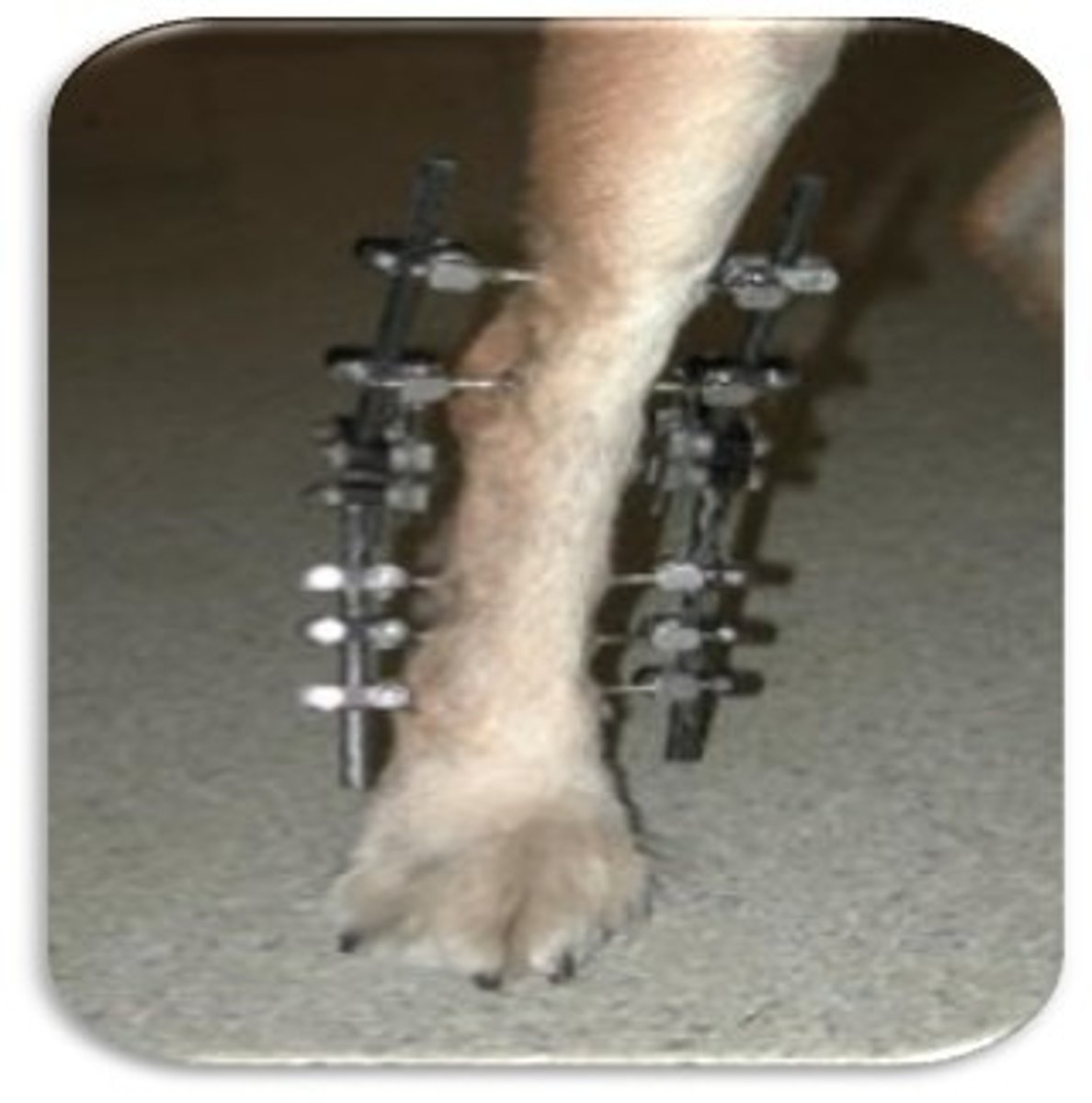 <p>-repair fracture with series of pins placed through skin and connected to connecting bar</p><p>-pins attached to bar with clamps or epoxyresin</p><p>-pins threaded or triangulation of pins to prevent pulling out</p>