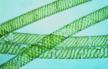 <p>What Genus is this algae?</p>