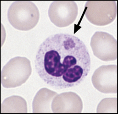 <p>what disease is affecting these and what is it</p>