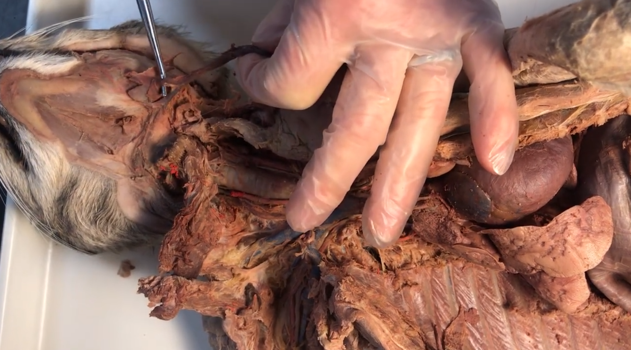 <p>What vein is this</p>