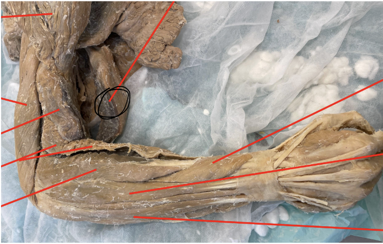 <p>what muscle does the marked image represent?</p>