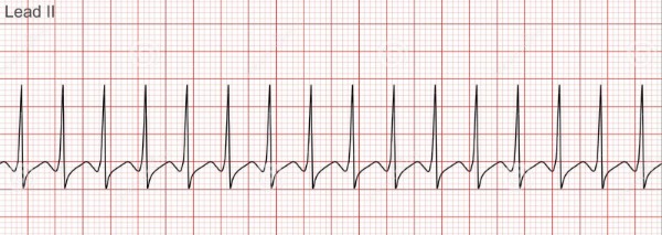 <p>What Rhythm is this?</p>