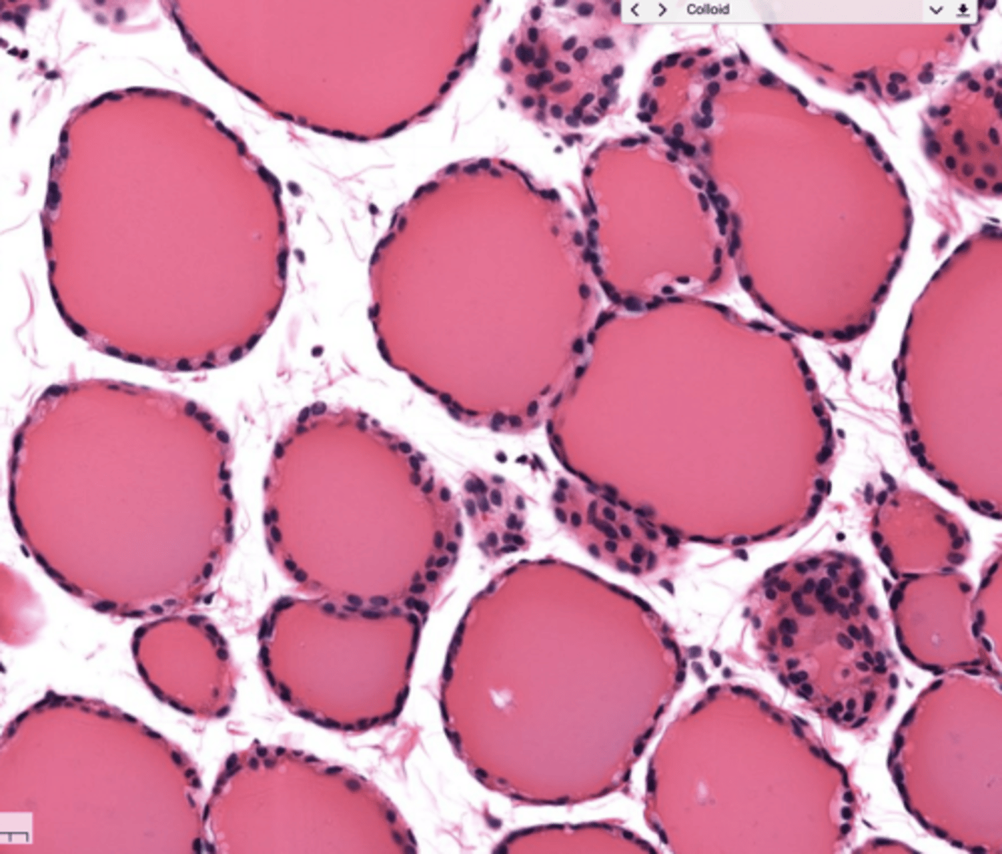 <p>In thyroid gland</p>