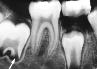 <p>what is indicated by the arrow: structure that forms dentin and pulp</p>