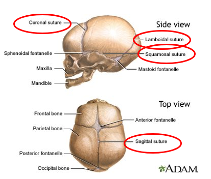 <p>coronal, lambdoidal, squamosal, and sagittal</p>