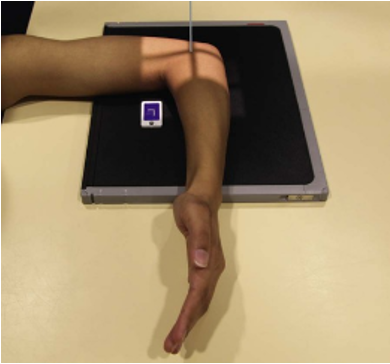 <p>What position would the radial tuberosity face for this position?</p>
