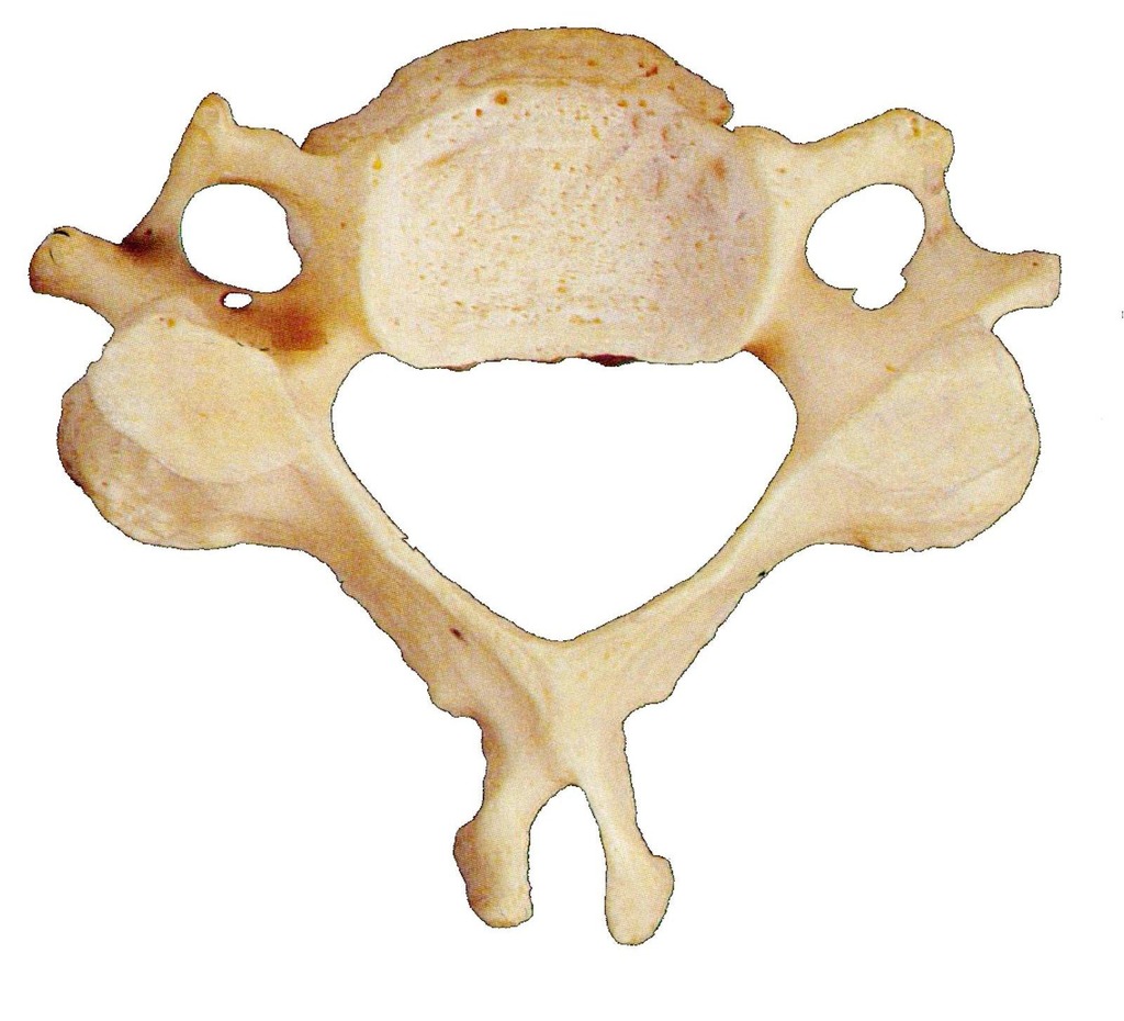 <p>Which vertebra is this? </p>