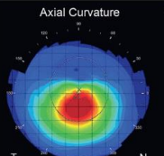 <ul><li><p>provides more global curvature</p></li><li><p>useful for GP lens fitting</p></li></ul>