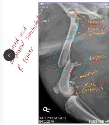 <p><span style="background-color: transparent;"><strong>Normal Blood Supply of Long Bones</strong></span></p>