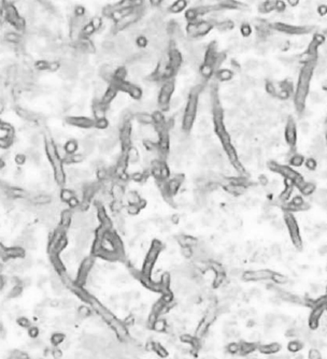 <p>fungal2</p>