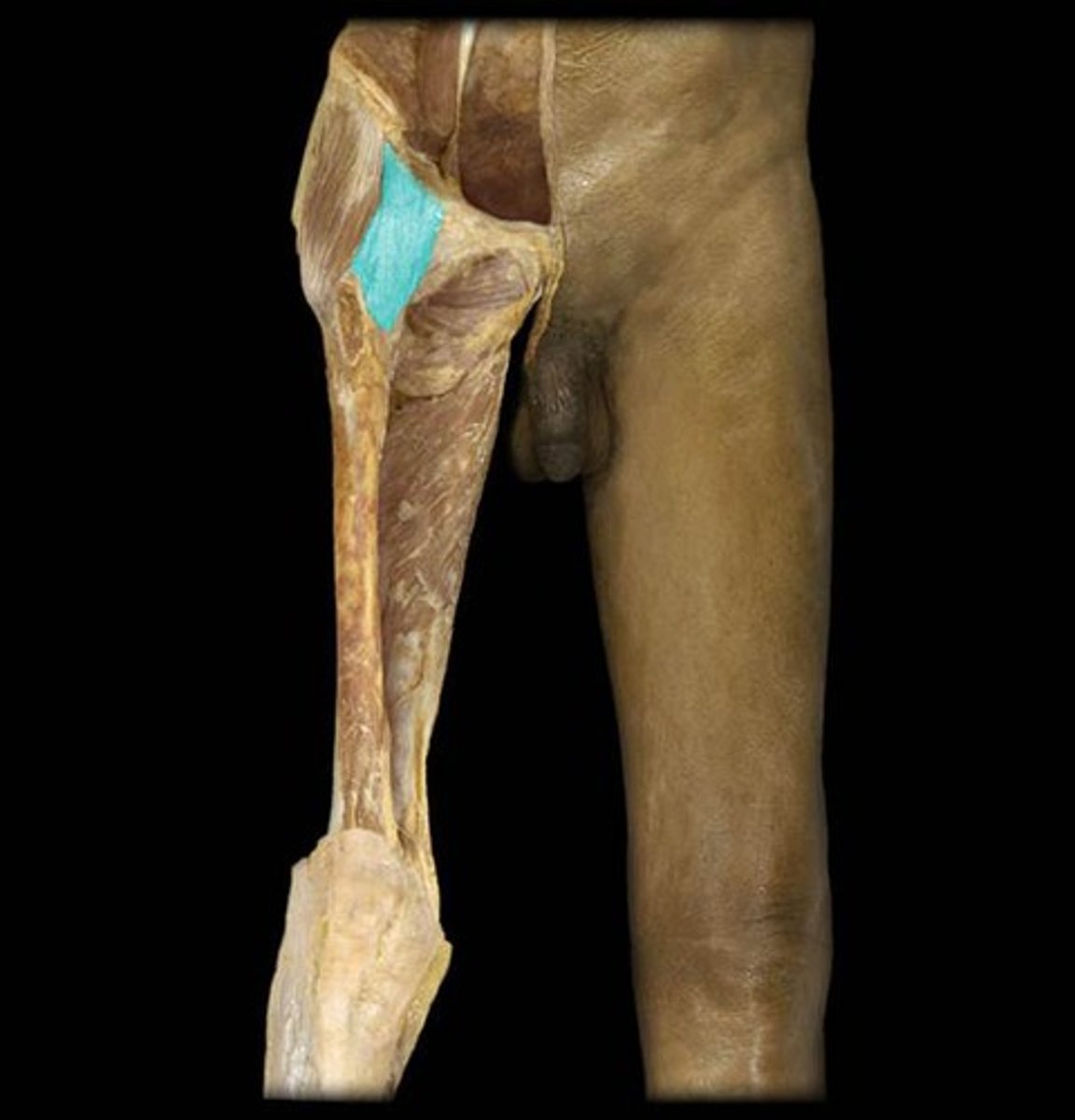 <p>Name this connective tissue structure.</p>