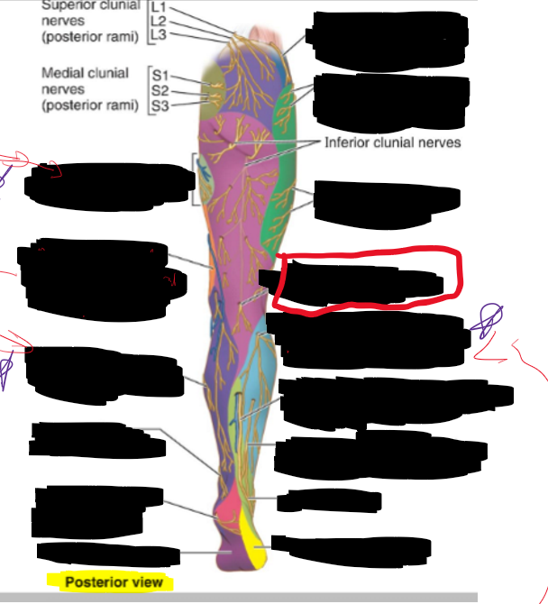 <p>What is the structure circled?</p>