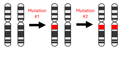 <p>• Two normal copies of <em>Retinoblastom</em>a gene at birth </p><p>• Sporadic mutations must occur twice to delete both copies </p><p>• Odds of two mutations<u> in the same cell</u> are very low (~ 10<sup>8</sup> retinoblasts per eye)</p><p>• Sporadic retinoblastoma is almost always restricted to one eye</p><p>• Sporadic ~60% of cases</p>