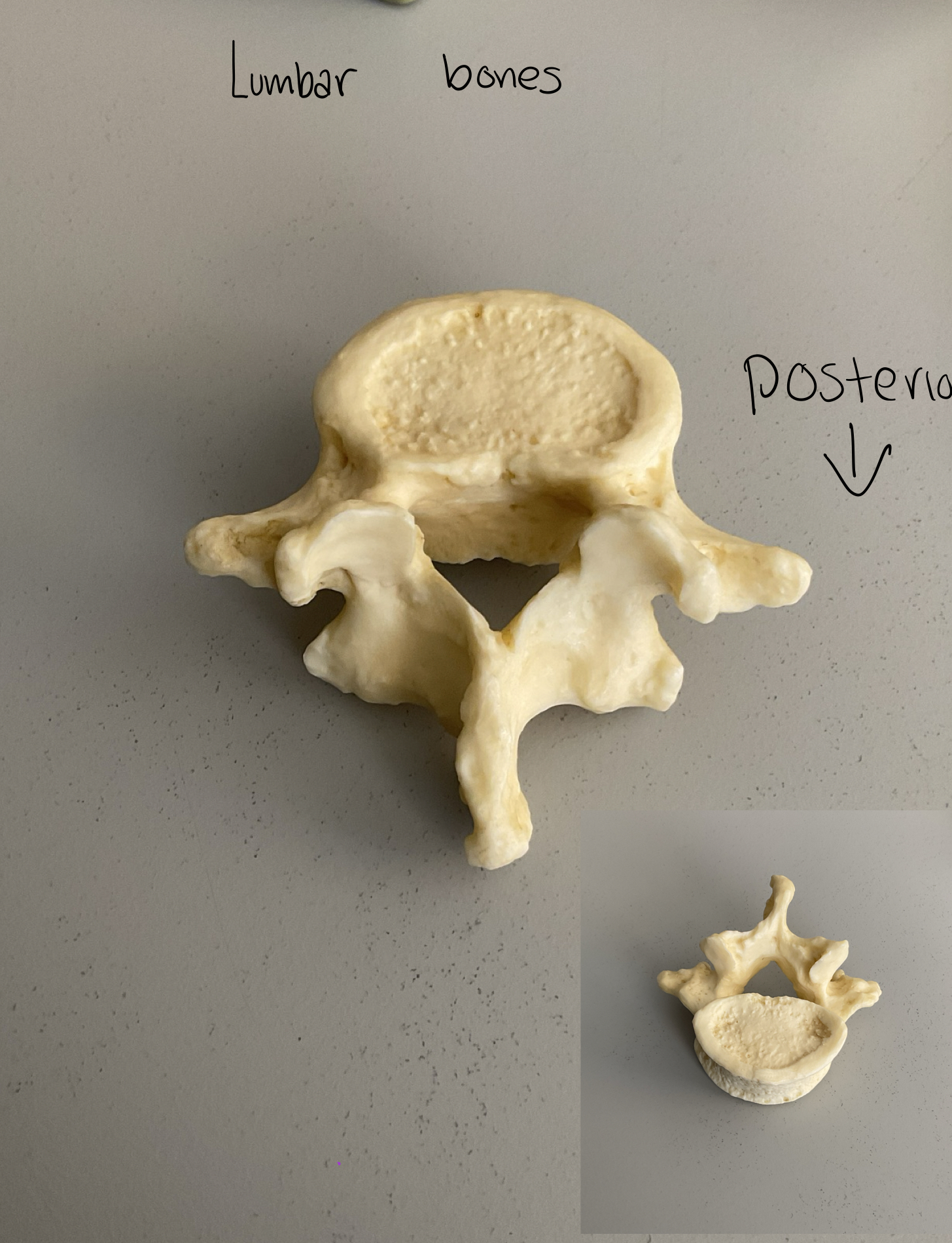 <p>Lumbar </p>
